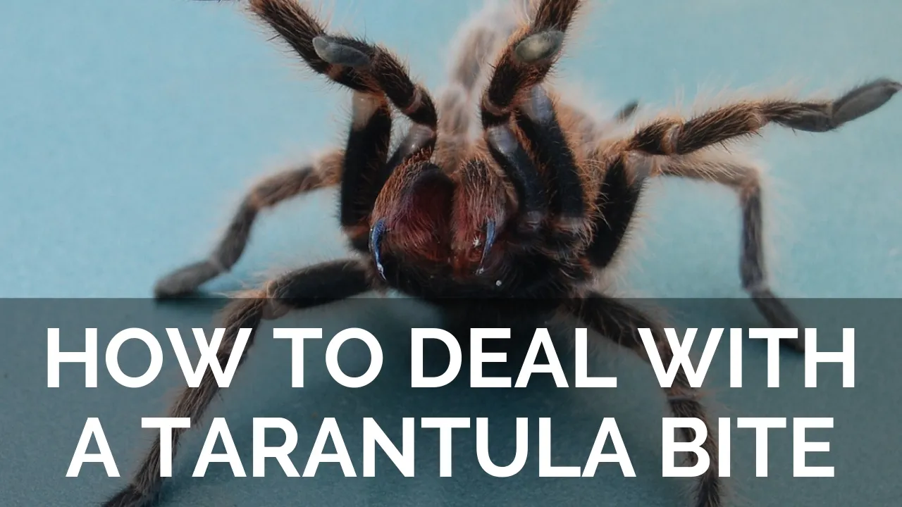 20860 tarantula handling safely