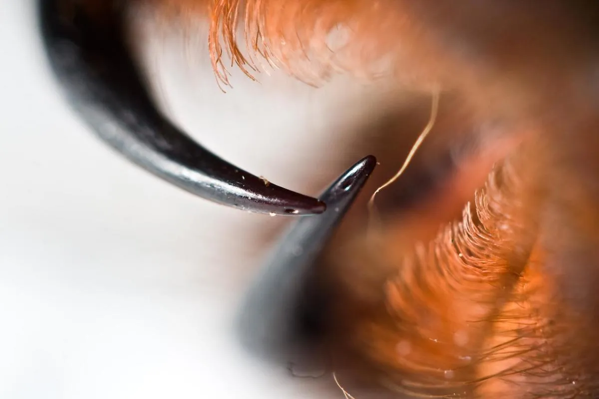 20984 tarantula bite symptoms